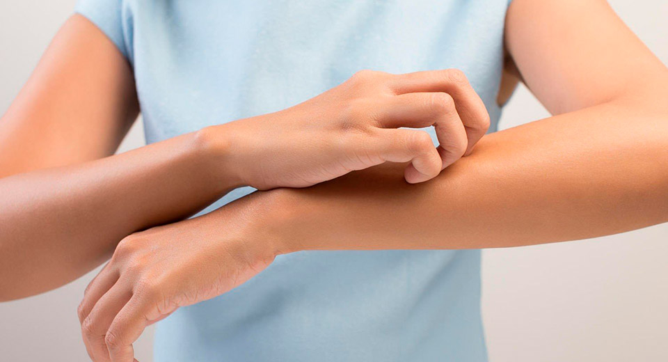 Как распознать кожную аллергию и вовремя ее вылечить